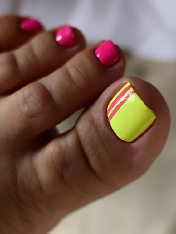 Summer Toe Nails Ideas 2025 That Pop with Color and Style for Beach and Vacation-Ready Looks